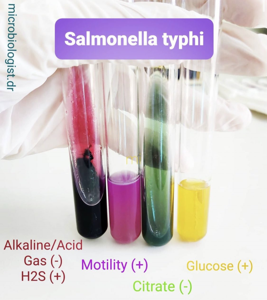 Biochemical test of Salmonella typhi