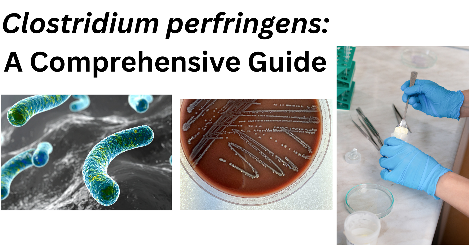 Clostridium perfringens: A Comprehensive Guide