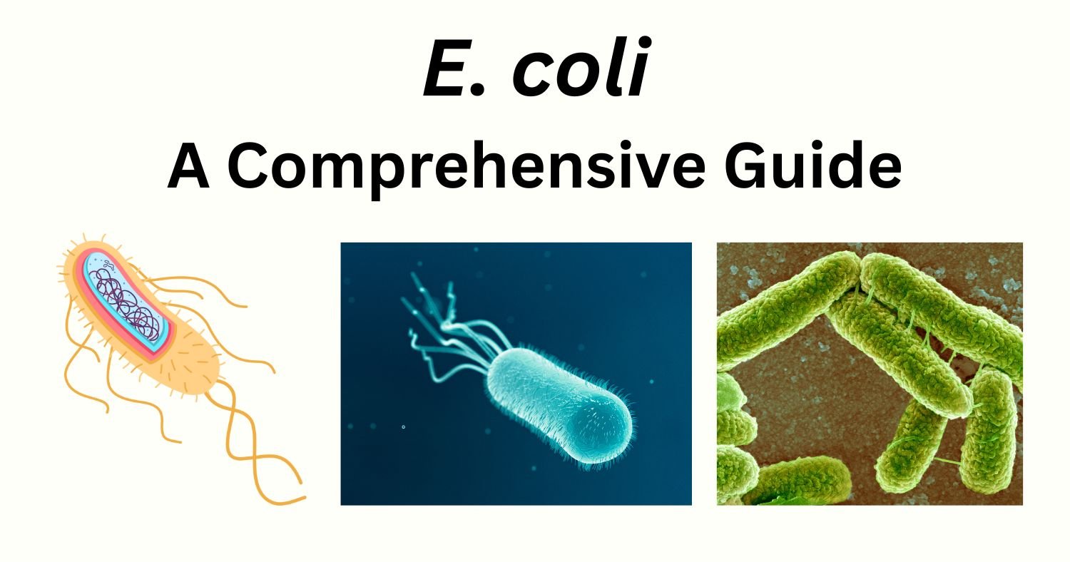 E coli (1) E coli 1