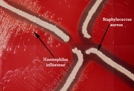 Haeemophilus influenzae