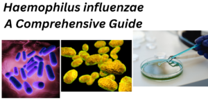Haemophilus influenzae
