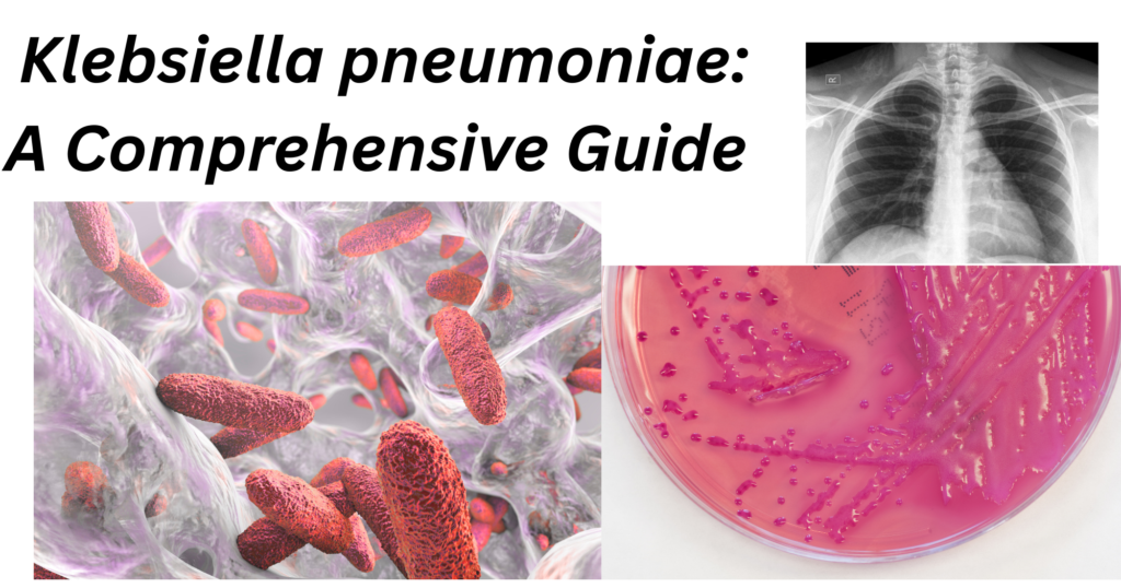 Klebsiella pneumoniae