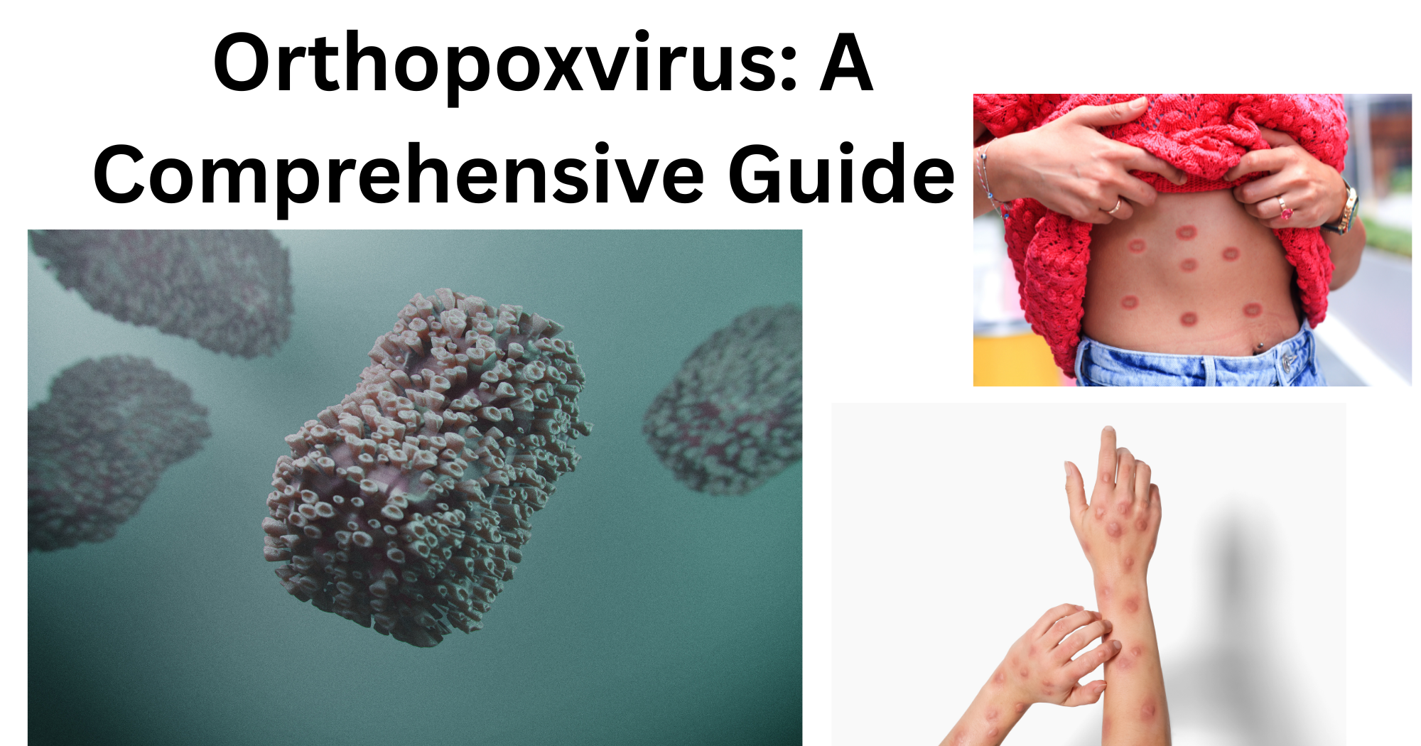 Orthopoxvirus