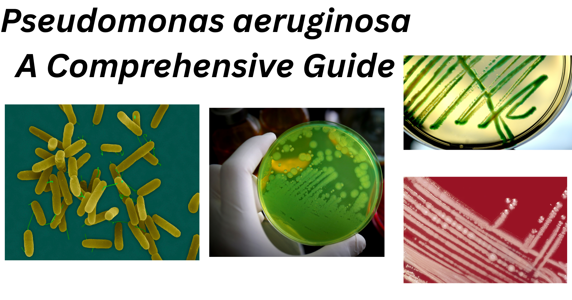 Pseudomonas aeruginosa Pseudomonas aeruginosa