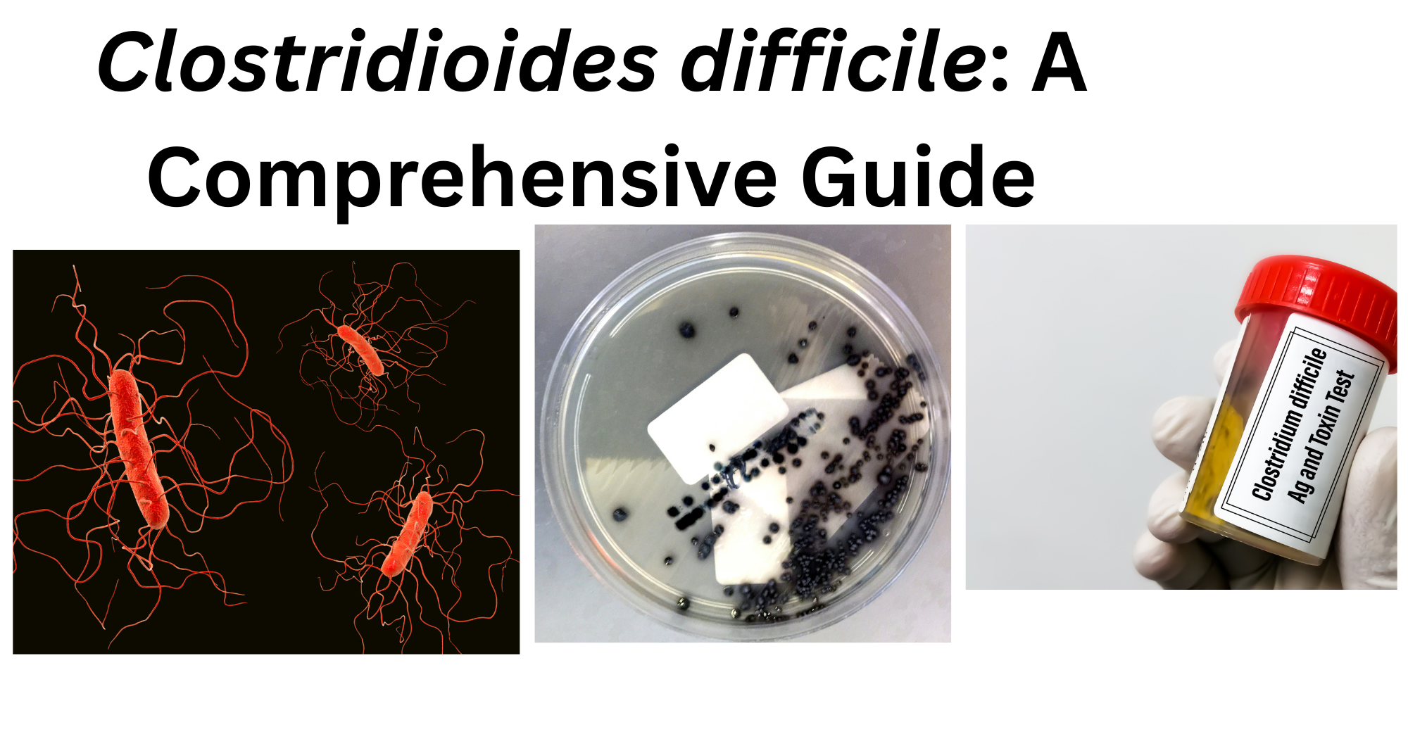 _Clostridioides difficile Clostridioides difficile