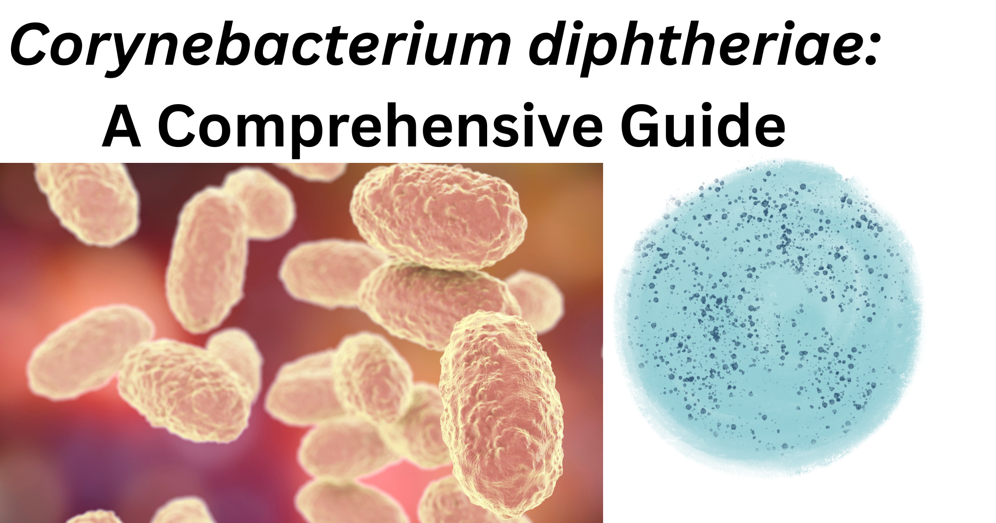 Corynebacterium diphtheriae Corynebacterium diphtheriae