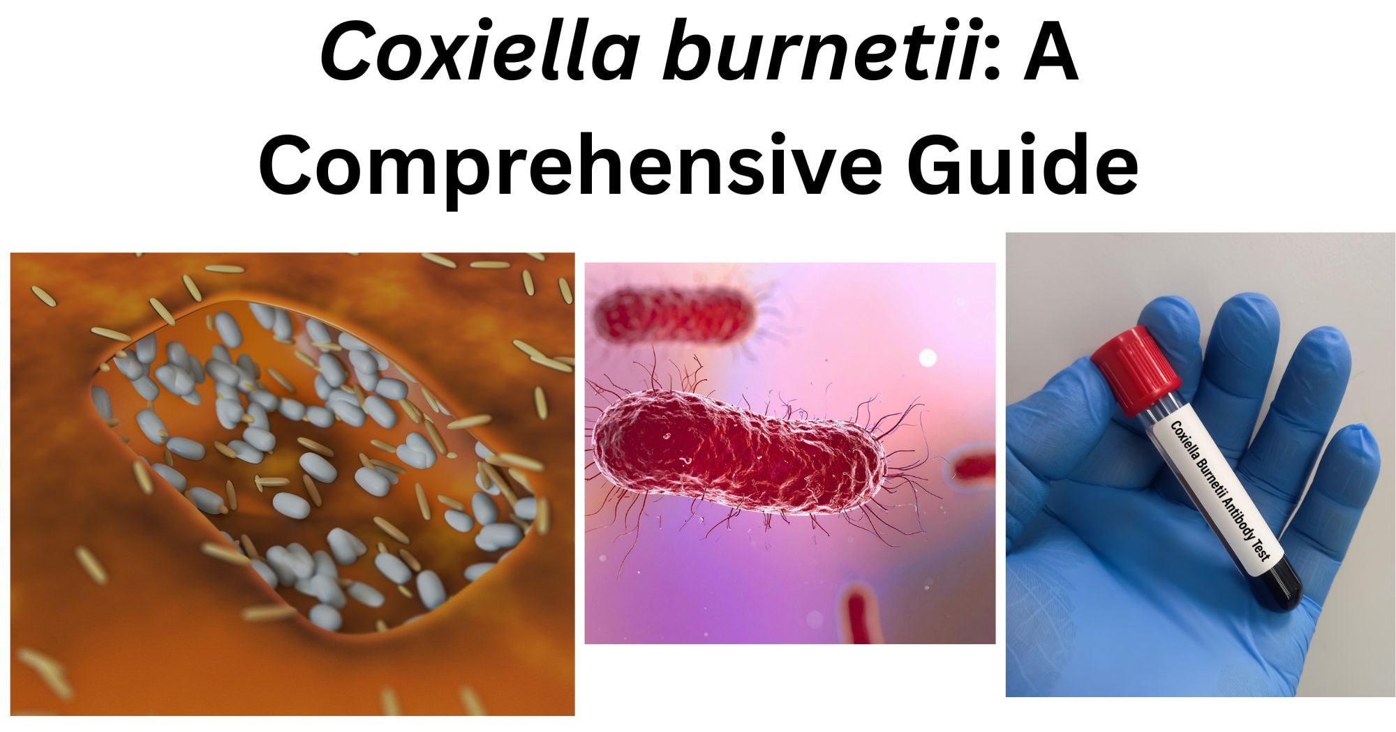 Coxiella burnetii Coxiella burnetii