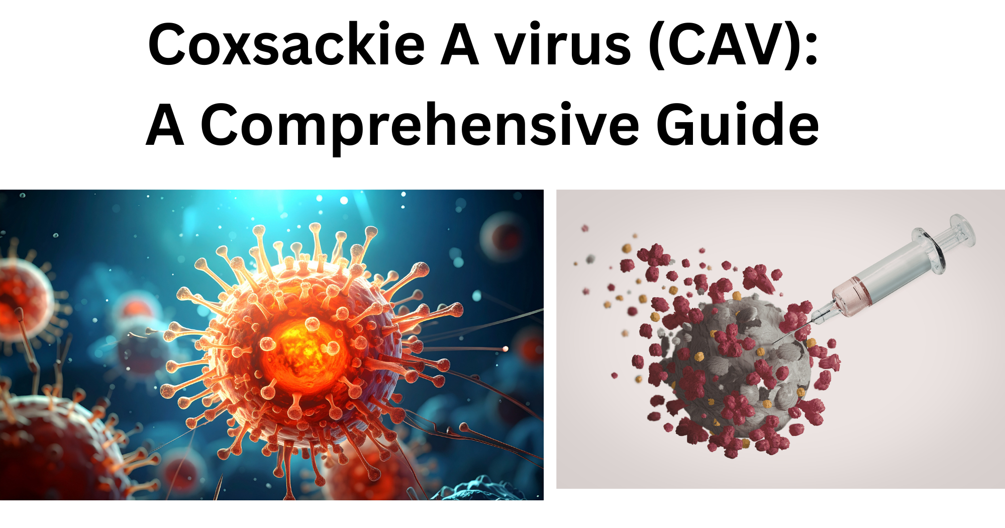 _Coxsackie A virus (CAV) Coxsackie A virus CAV