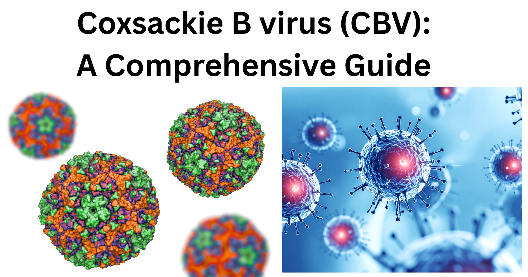 _Coxsackie B virus (CBV) Coxsackie B virus CBV