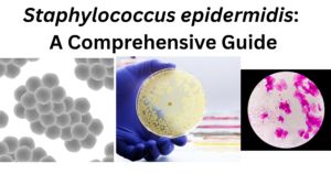 Staphylococcus epidermidis