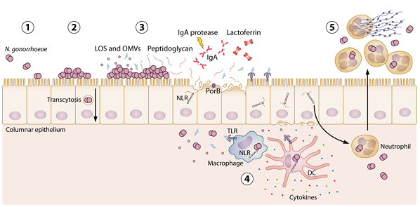 summary of N. gonorrrhea 1 1